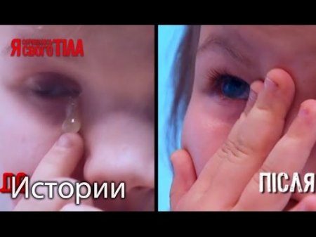 Шестилетнюю Диану Гриб избавили от постоянного скапливания гноя в глазках  - (видео)