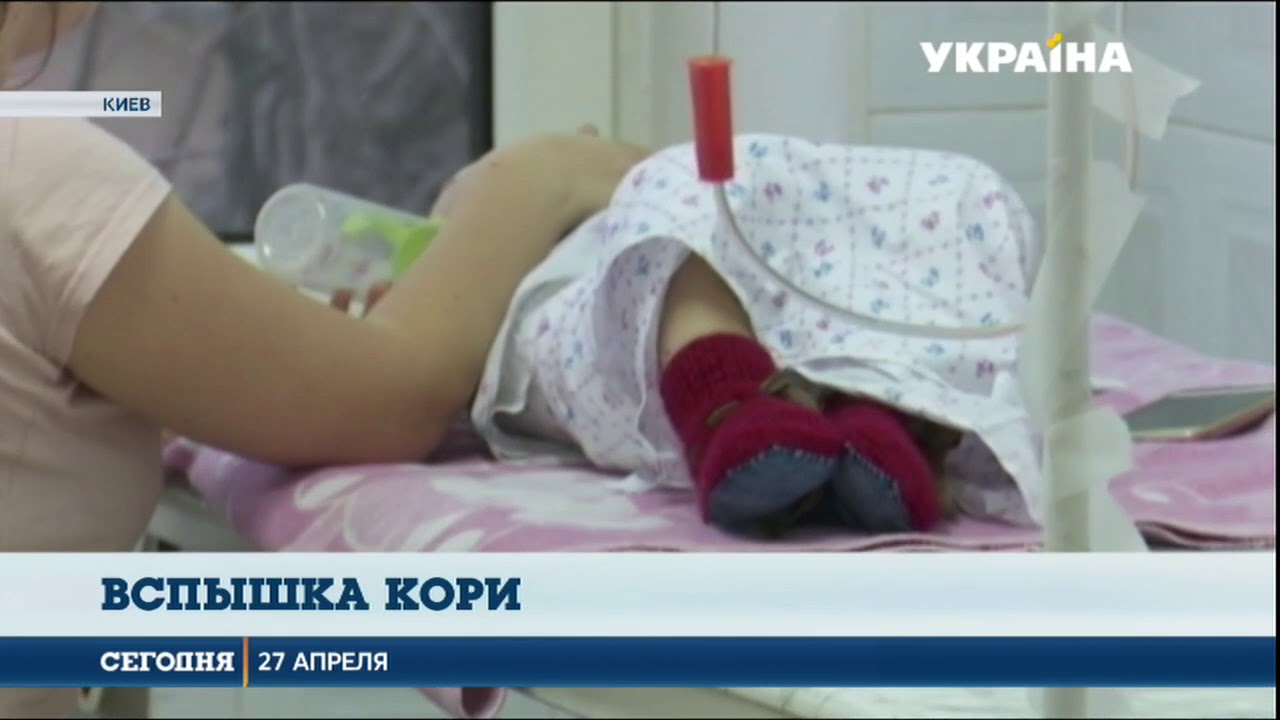 В Украине снова вспышка кори  - (видео)
