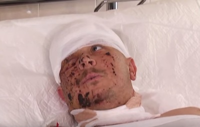 Выживший боец рассказал об обстреле КрАЗа под Гранитным - (видео)