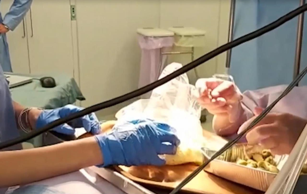 Во время операции на мозге пациентка готовила еду - (видео)